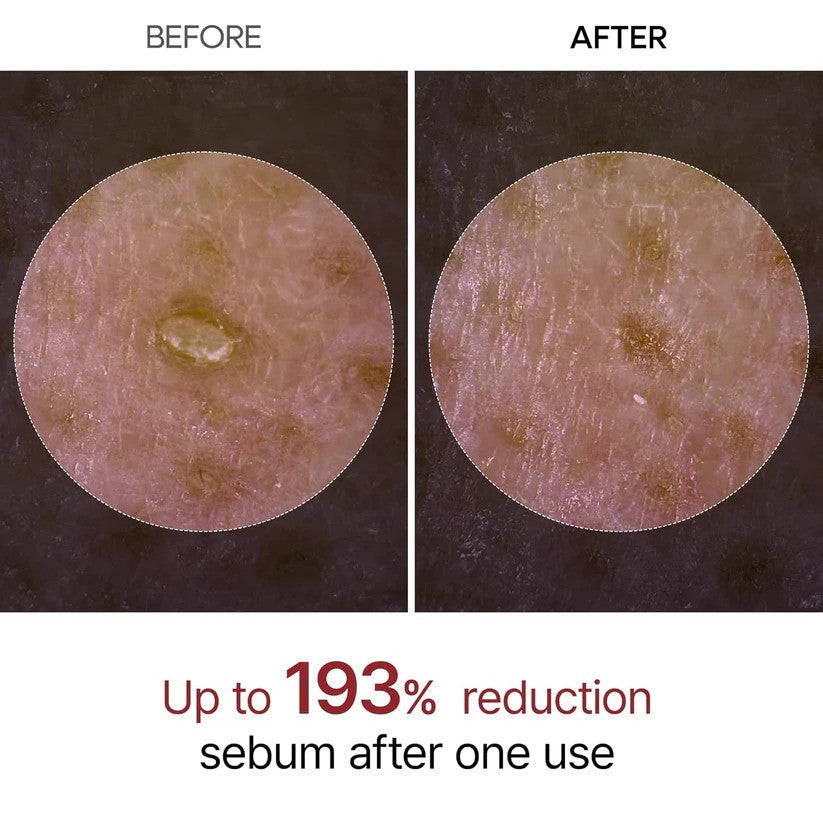 Peel Shot Ampoule