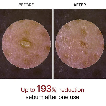 Peel Shot Ampoule